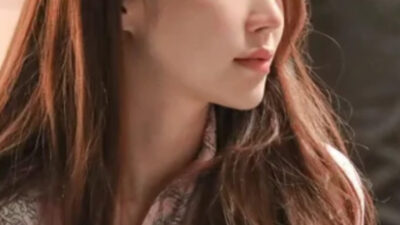 Popular Actress Reveals Burn Scar On Her Face For The First Time—Here's What Happened