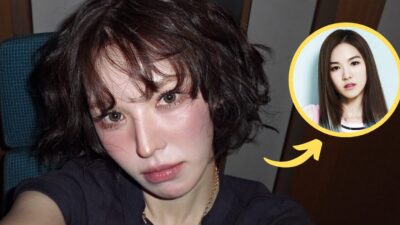 Red Velvet Wendy's Viral Plastic Surgery Allegations Spark Heated Reactions