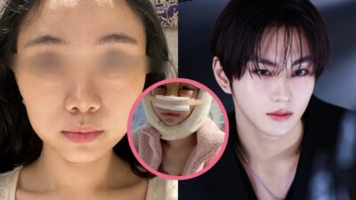 Woman's "Eerie" Plastic Surgery Transformation Into ENHYPEN's Jungwon Sparks Debate