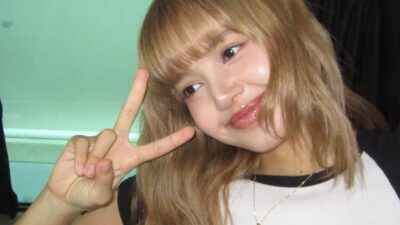 BLACKPINK’s Lisa Breaks Silence On Shocking Injury Photo