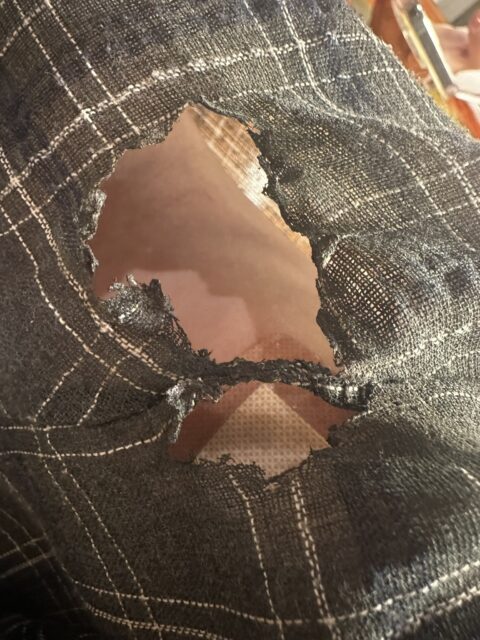 Burn injuries from SEVENTEEN concert