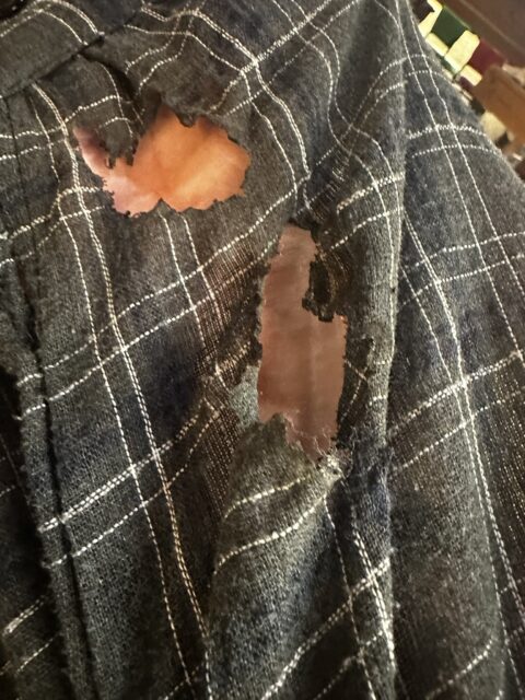 Burn injuries from SEVENTEEN concert