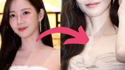 Actress Park Min Young Shocks With Worrying Visuals After Weight Loss