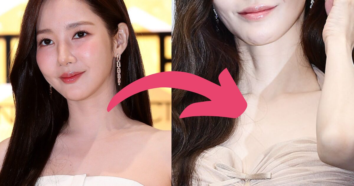 Actress Park Min Young Shocks With Worrying Visuals After Weight Loss
