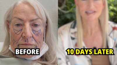 Move Over, Korea — 58-Year-Old Woman Looks Decades Younger After Viral Makeover In "New Plastic Surgery Capital"