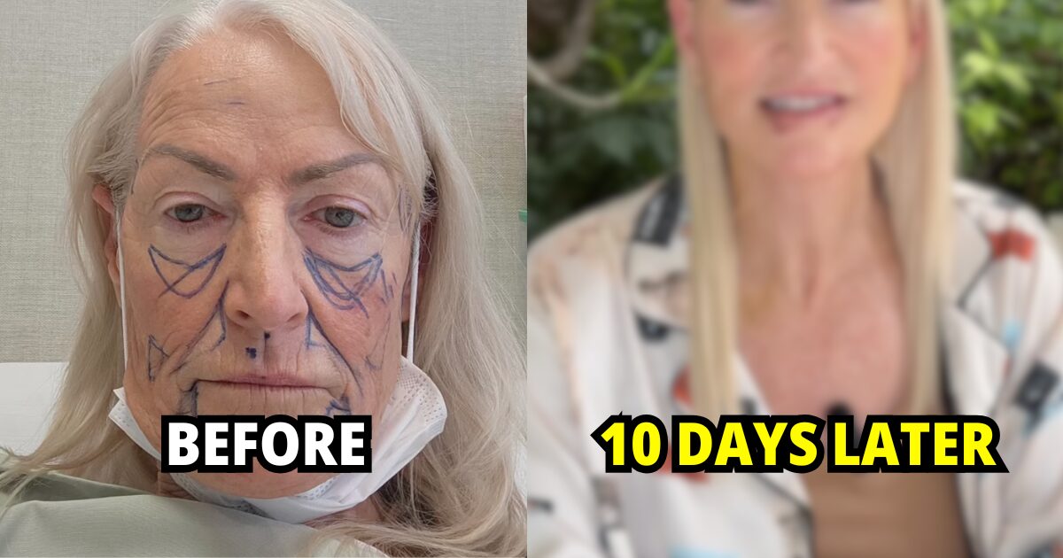 Move Over, Korea — 58-Year-Old Woman Looks Decades Younger After Viral Makeover In "New Plastic Surgery Capital"