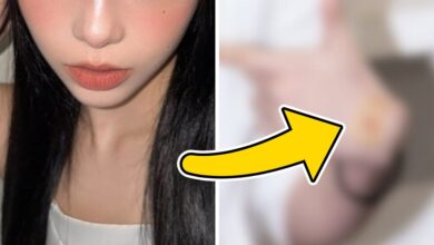 SM Entertainment Star's Shocking Bruises Trigger Concern